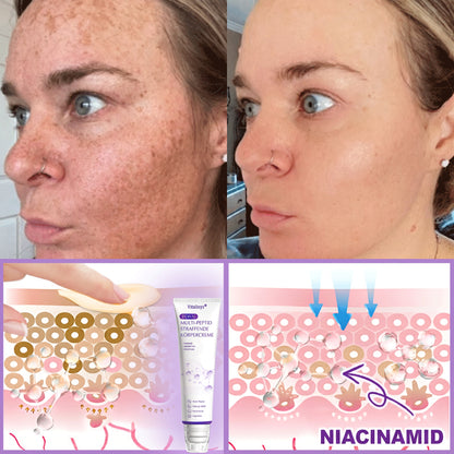 💎FDA-zertifiziert: Vitalisys® PDRN Multi-Peptide Massaging Body Roller Cream – Anti-Aging, Feuchtigkeit, Hautstraffung & Lifting, Hautpflege, ebenmäßiger Hautton, Akne- & Fleckenpflege, Warzen- & Muttermalentfernung, Psoriasis-Linderung.🍇