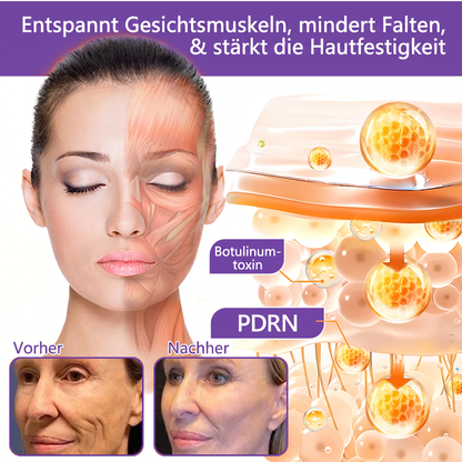 💎FDA-zertifiziert: Vitalisys® PDRN Multi-Peptide Massaging Body Roller Cream – Anti-Aging, Feuchtigkeit, Hautstraffung & Lifting, Hautpflege, ebenmäßiger Hautton, Akne- & Fleckenpflege, Warzen- & Muttermalentfernung, Psoriasis-Linderung.🍇