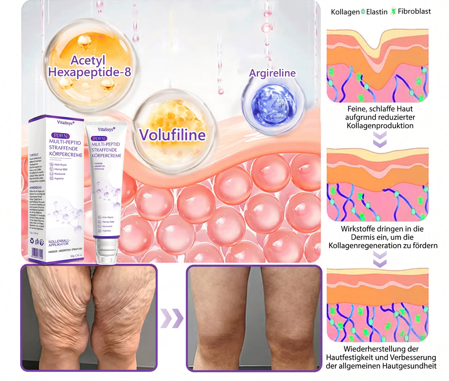 💎FDA-zertifiziert: Vitalisys® PDRN Multi-Peptide Massaging Body Roller Cream – Anti-Aging, Feuchtigkeit, Hautstraffung & Lifting, Hautpflege, ebenmäßiger Hautton, Akne- & Fleckenpflege, Warzen- & Muttermalentfernung, Psoriasis-Linderung.🍇