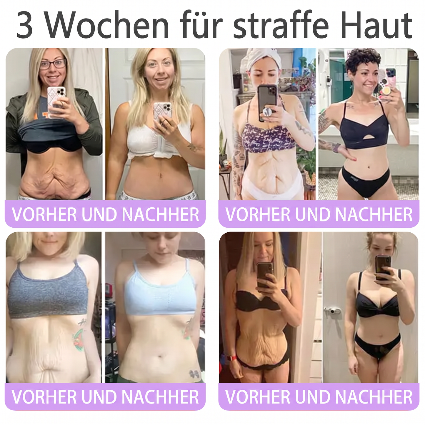 💎FDA-zertifiziert: Vitalisys® PDRN Multi-Peptide Massaging Body Roller Cream – Anti-Aging, Feuchtigkeit, Hautstraffung & Lifting, Hautpflege, ebenmäßiger Hautton, Akne- & Fleckenpflege, Warzen- & Muttermalentfernung, Psoriasis-Linderung.🍇