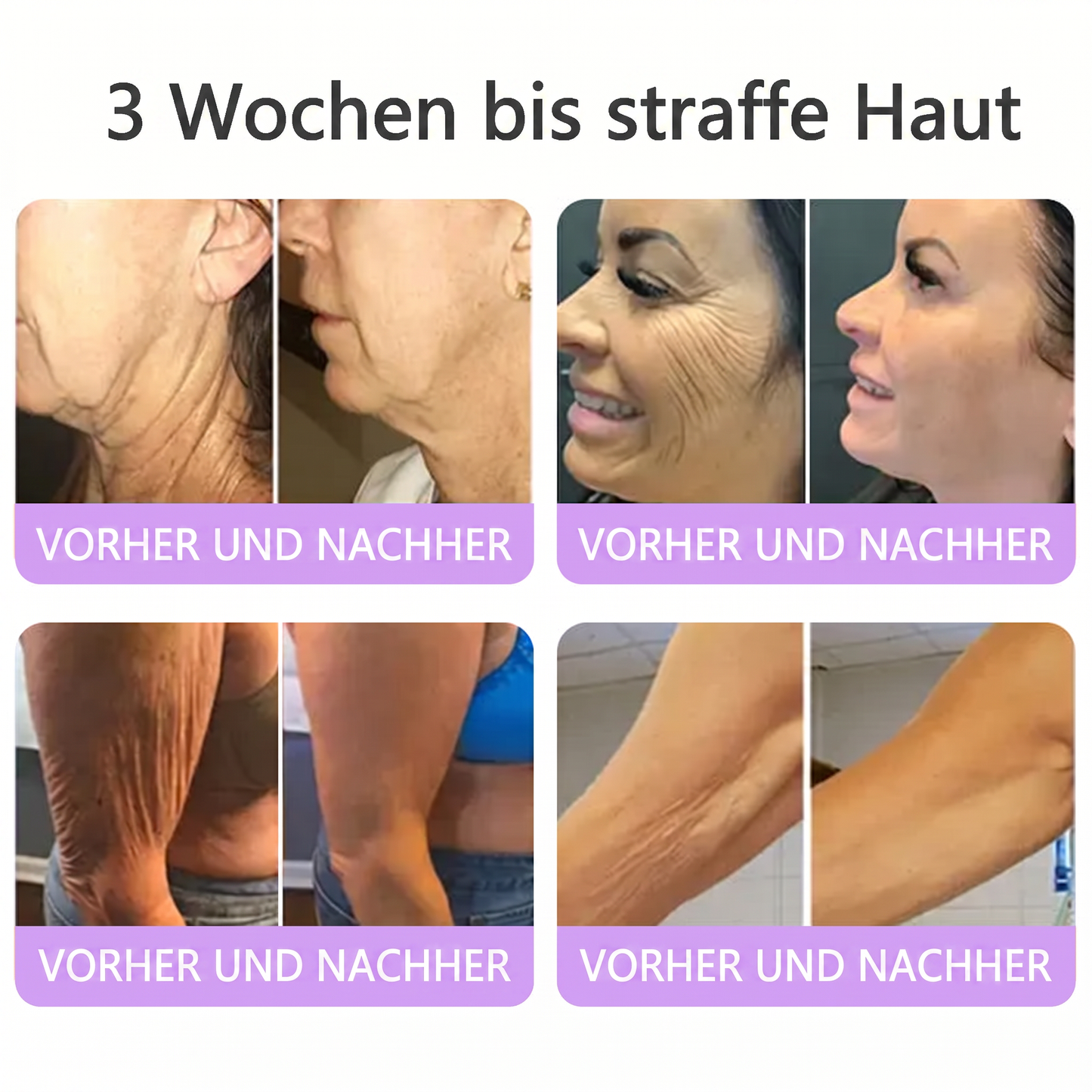 💎FDA-zertifiziert: Vitalisys® PDRN Multi-Peptide Massaging Body Roller Cream – Anti-Aging, Feuchtigkeit, Hautstraffung & Lifting, Hautpflege, ebenmäßiger Hautton, Akne- & Fleckenpflege, Warzen- & Muttermalentfernung, Psoriasis-Linderung.🍇