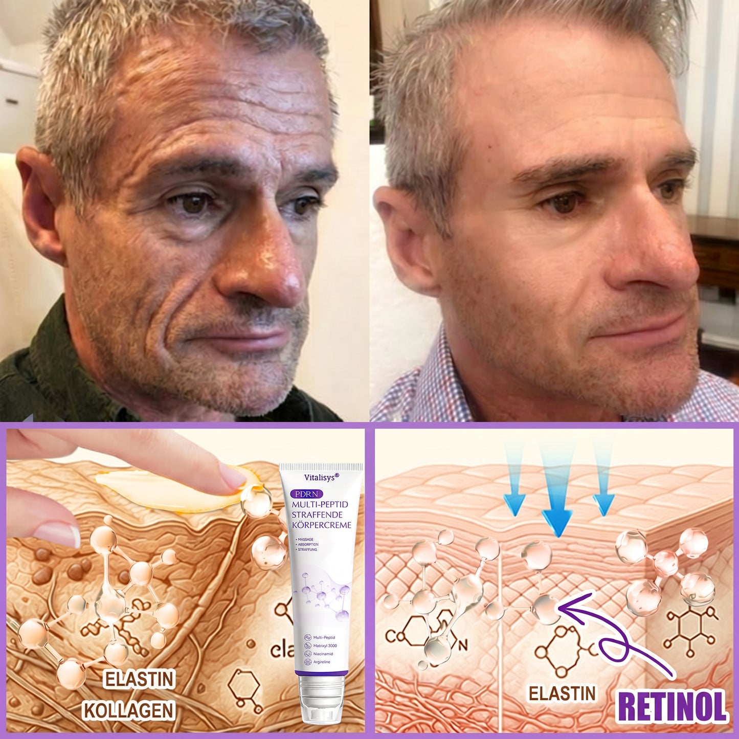 💎FDA-zertifiziert: Vitalisys® PDRN Multi-Peptide Massaging Body Roller Cream – Anti-Aging, Feuchtigkeit, Hautstraffung & Lifting, Hautpflege, ebenmäßiger Hautton, Akne- & Fleckenpflege, Warzen- & Muttermalentfernung, Psoriasis-Linderung.🍇